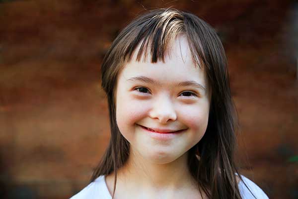 smiling happy girl with downs syndrome